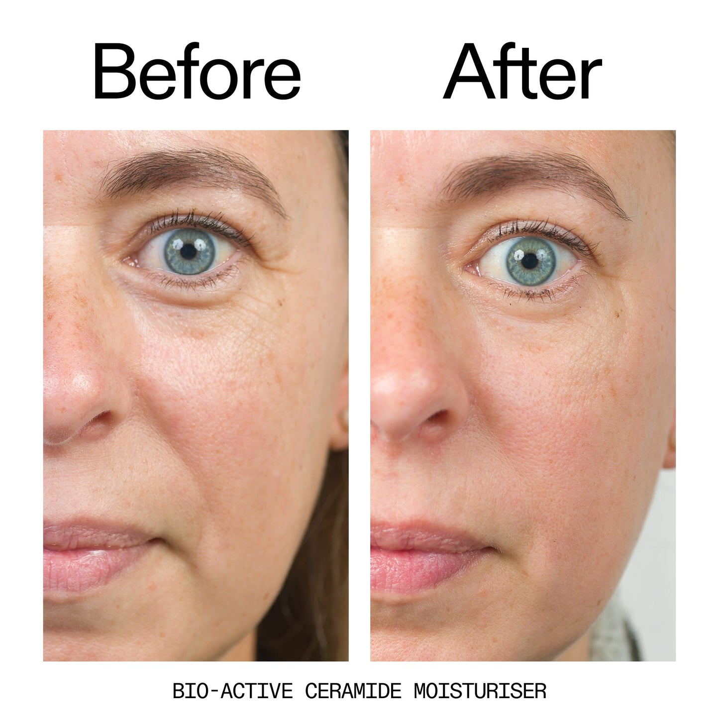 barrier-boosting-trio-c8 Bio-Active_Before_After_2000x2000_600947b4-e8c5-425a-9155-fc15bc83aa12.jpg