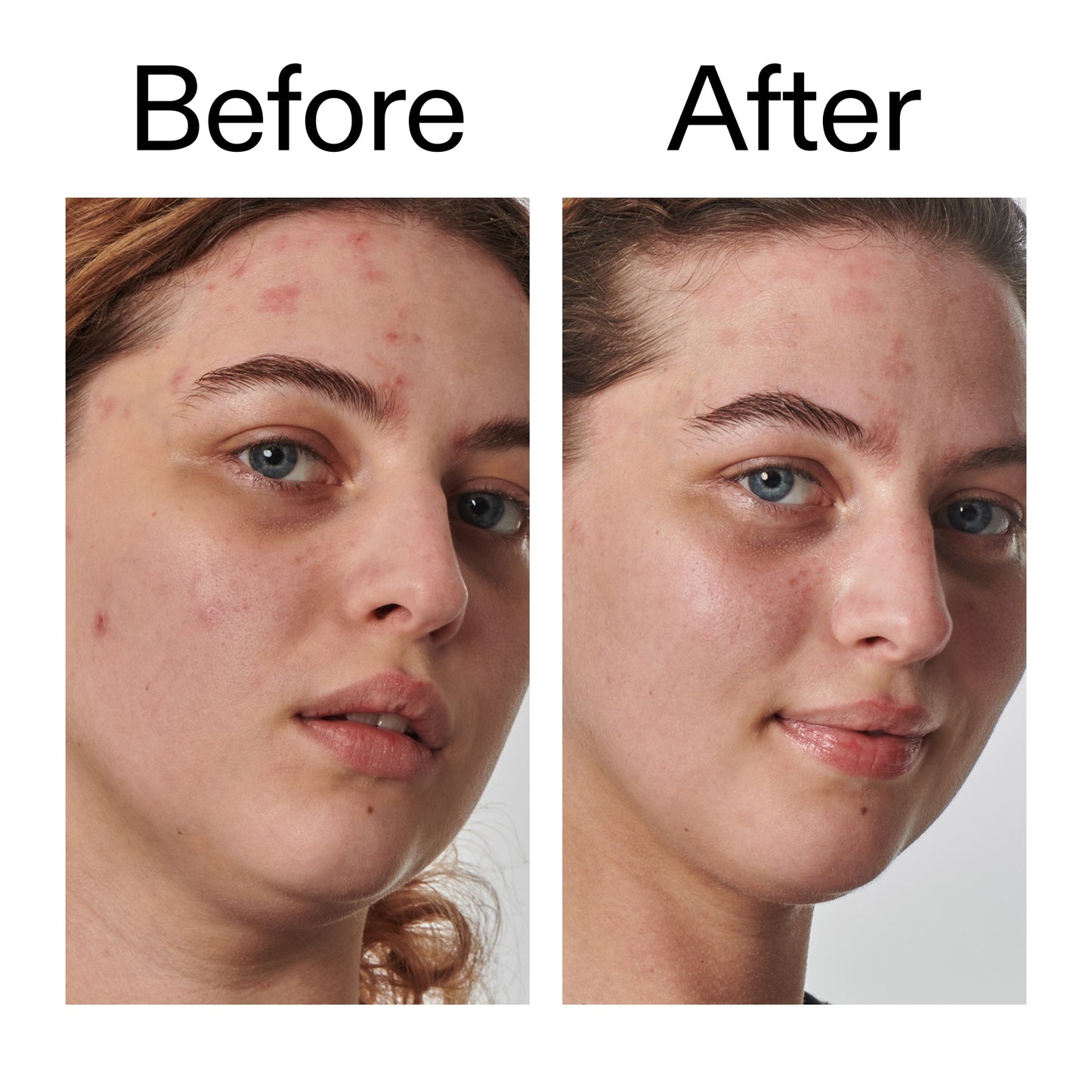 10-urea-moisturizer-g3 Dry_and_Rough_Skin_Solution_Before_After_2000x2000_efa6e639-5c39-49bd-a5dd-f0220293120a.jpg