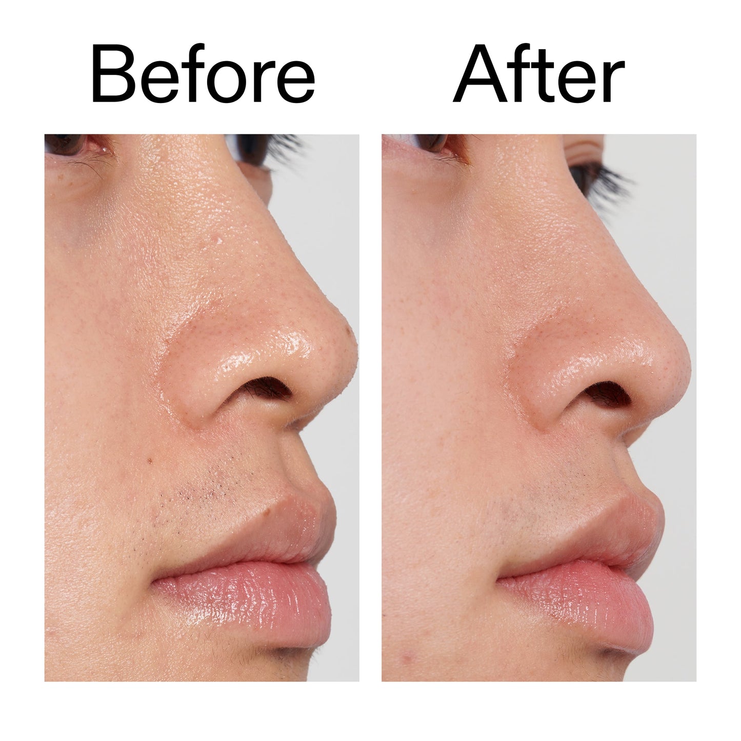 pha-toner-r9 PHA_Toner_Before_After_2000x2000_e3c10172-0150-4342-8b95-57417eaff50d.jpg
