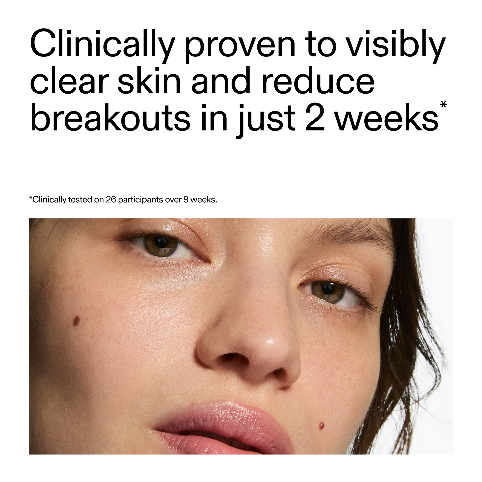 360-acne-clearing-serum-u2 360_Serum_Key_Claim.png