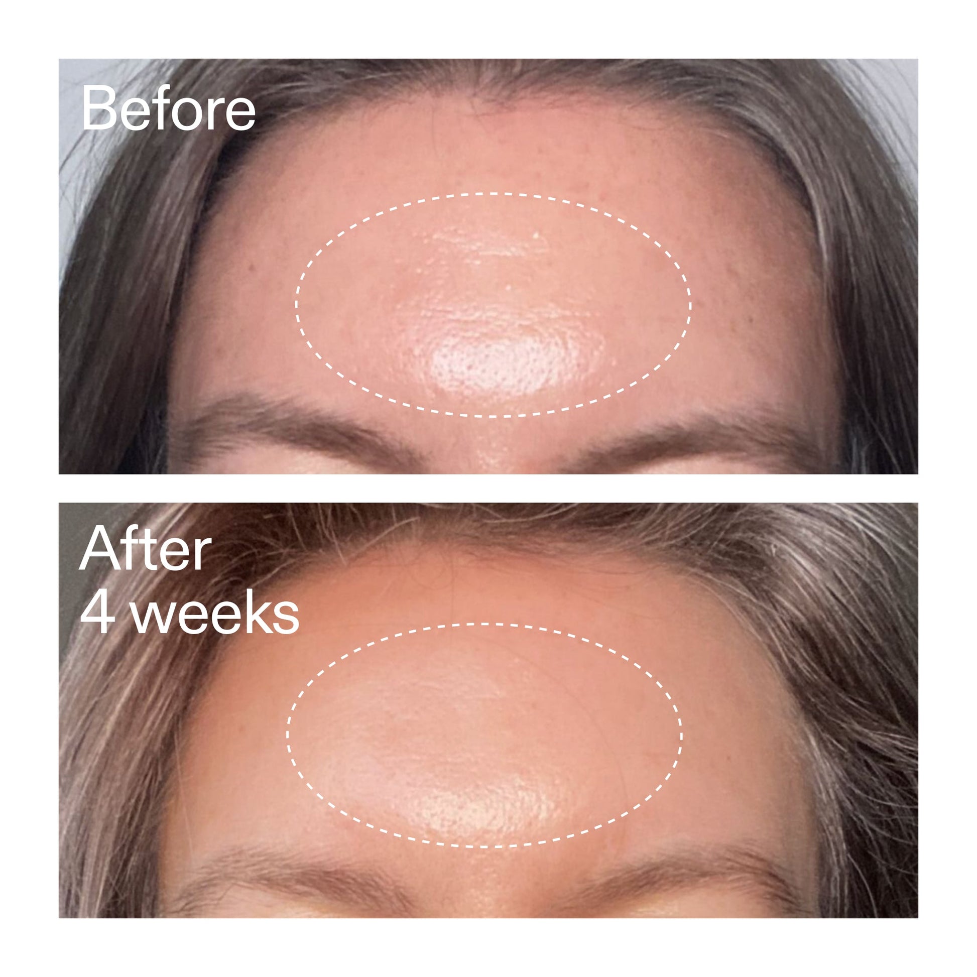 advanced-0-2-retinal-serum-duo-n9 AdvancedRetinal_BeforeAfter1_2000x2000_4e9c798a-f30e-45b8-a34a-7c4740f2f2cb.jpg
