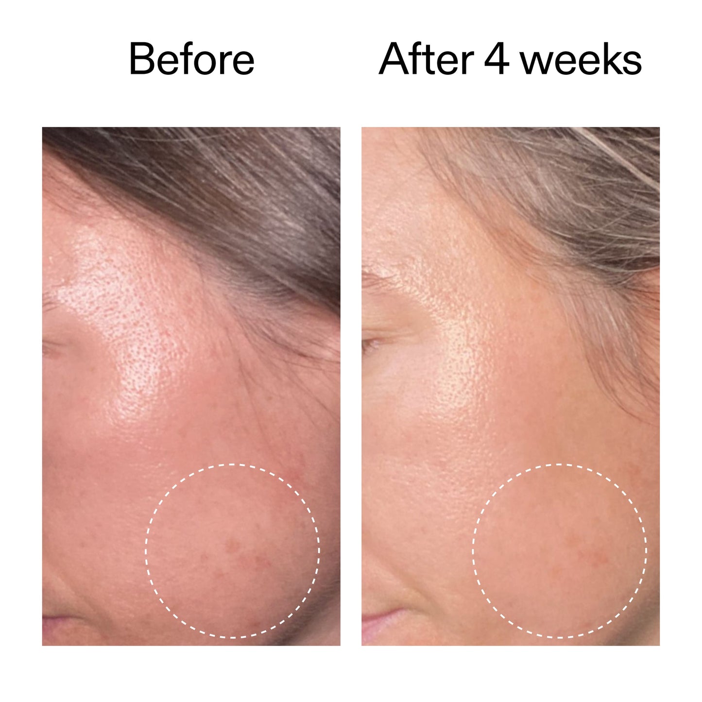 advanced-0-2-retinal-serum-duo-n9 AdvancedRetinal_BeforeAfter2__2000x2000_8ef75542-2316-4814-81ee-0f66a85912bc.jpg