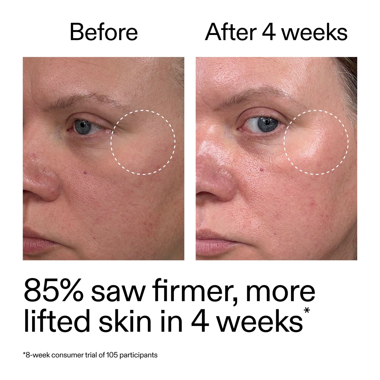 advanced-0-2-retinal-serum-duo-n9 AdvancedRetinal_BeforeAfter_Claim1_2000x2000_3a315aa8-f408-4b33-bbeb-0d9209f98404.jpg