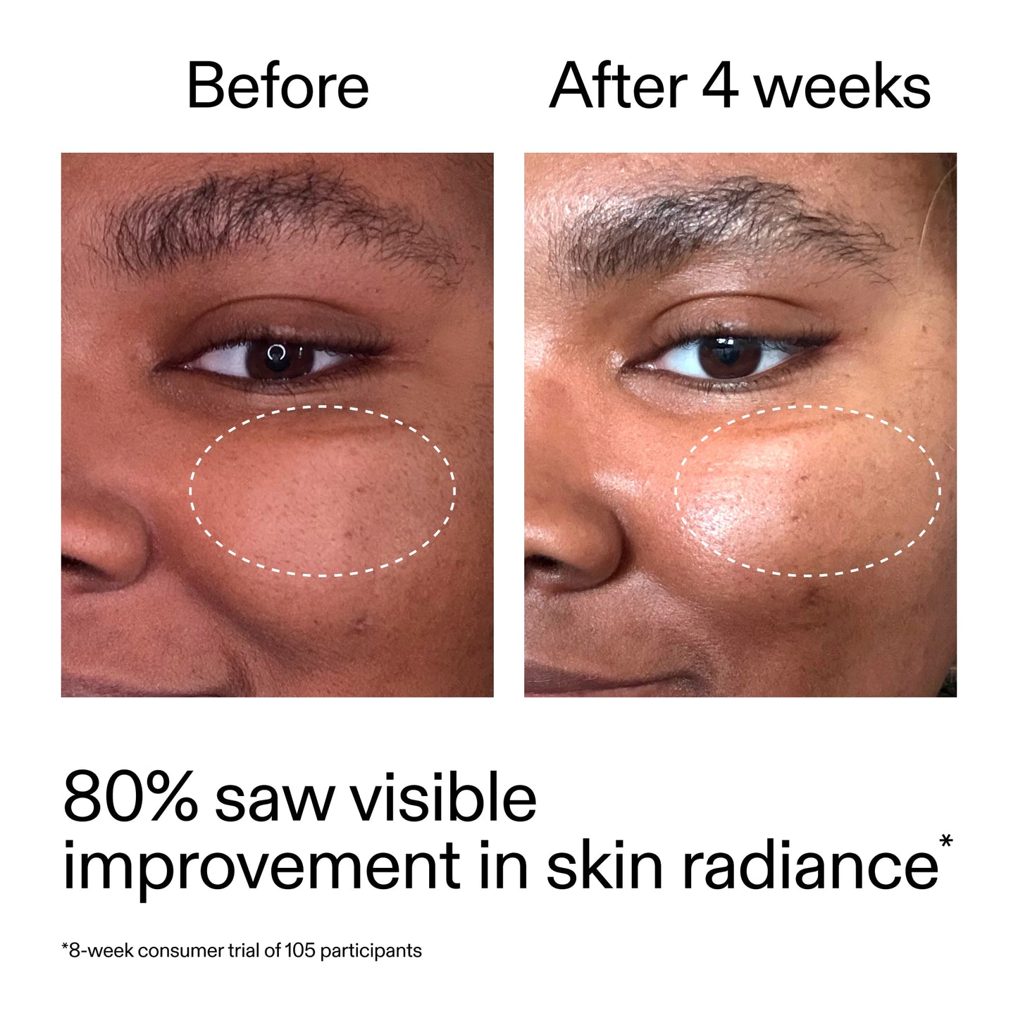 advanced-0-2-retinal-serum-duo-n9 AdvancedRetinal_BeforeAfter_Claim2_2000x2000_681b621d-8d44-4d44-9a40-89244f9b2e53.jpg