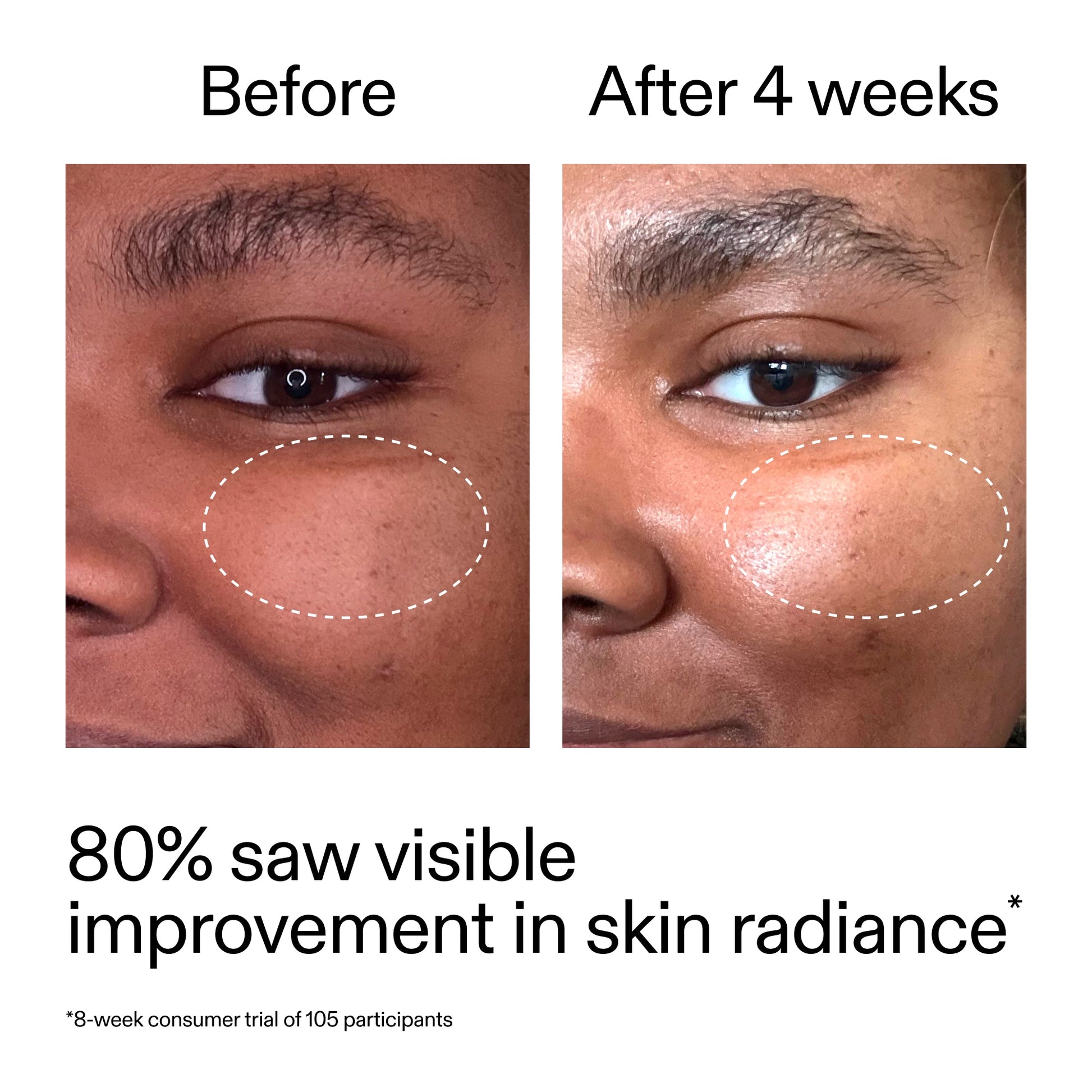 advanced-0-2-retinal-serum-duo-n9 AdvancedRetinal_BeforeAfter_Claim2_2000x2000_681b621d-8d44-4d44-9a40-89244f9b2e53.jpg