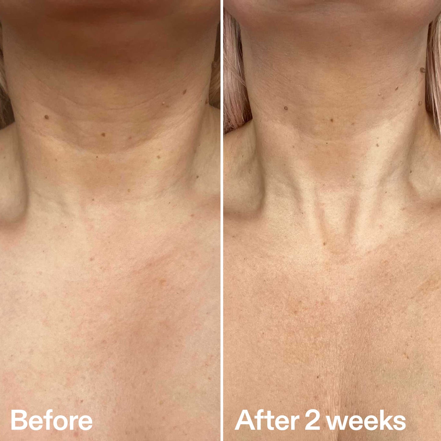 bio-active-neck-lift-stick-z8 B_A_2.jpg