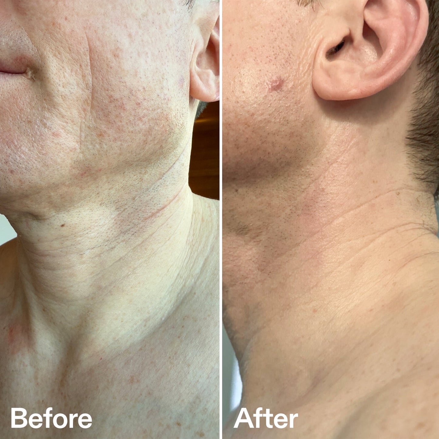 bio-active-neck-lift-stick-z8 B_A_afa2743e-b8e2-4504-92f4-e281cb6cf759.jpg