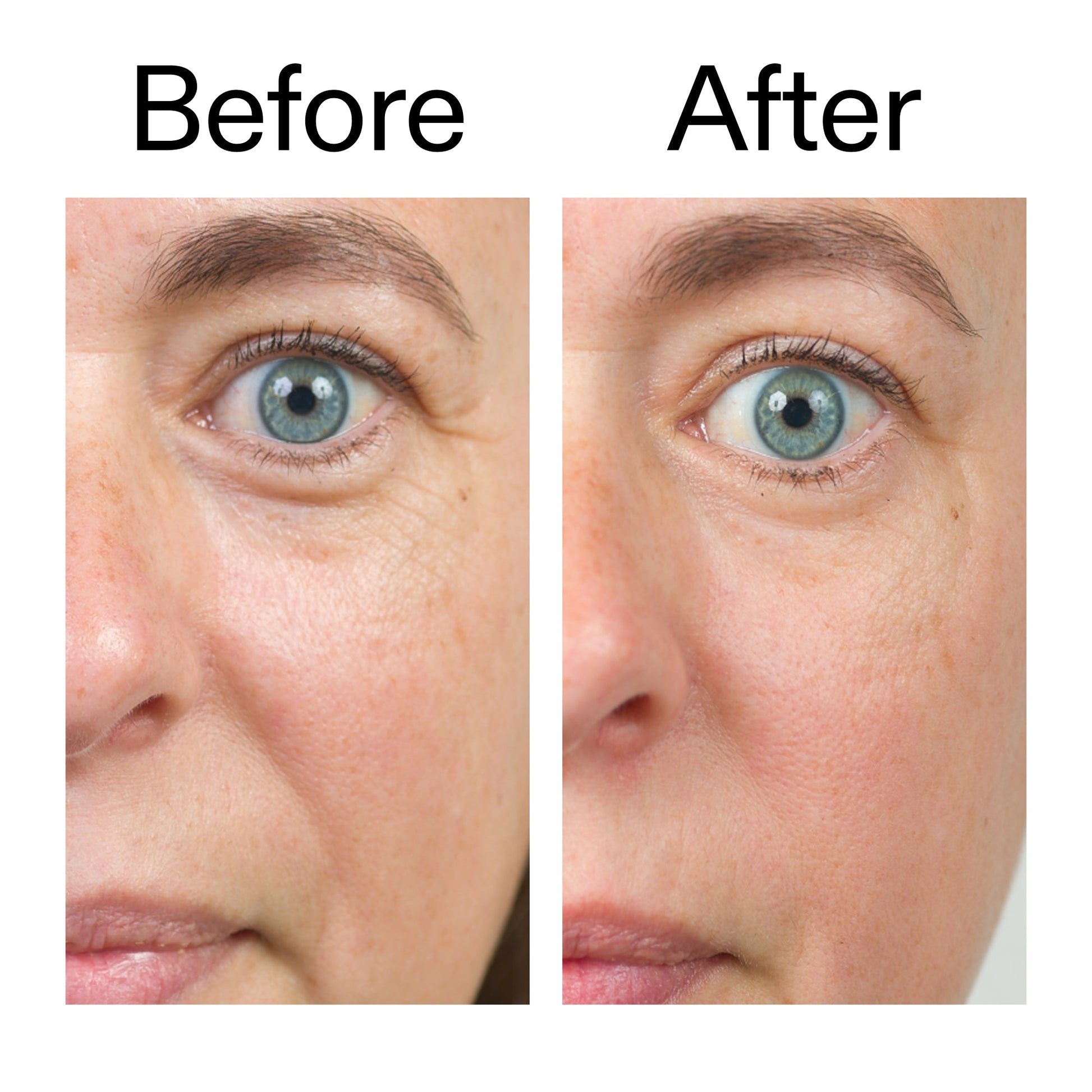 bio-active-ceramide-moisturizer-duo-p0 Bio-Active_Before_After_2000x2000_566e5a9e-135e-417a-8242-b44e5fa35463.jpg