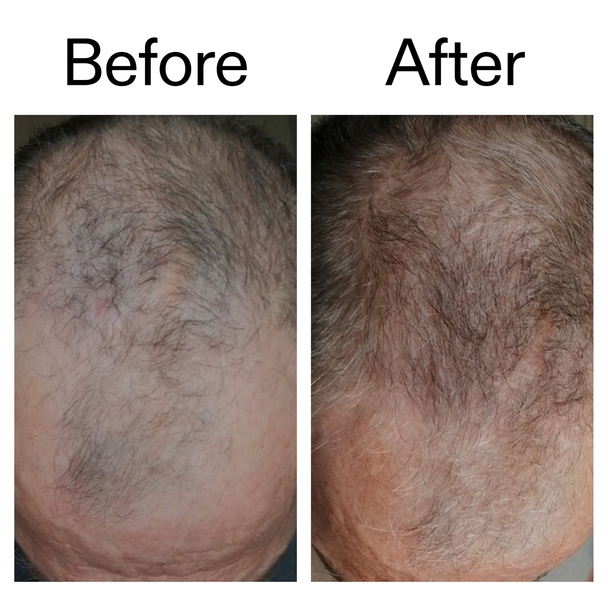 3-month-hair-growth-trio-n7 Caffeine_Scalp_Treatment_B_A_Ppage_2000_x_2000.jpg