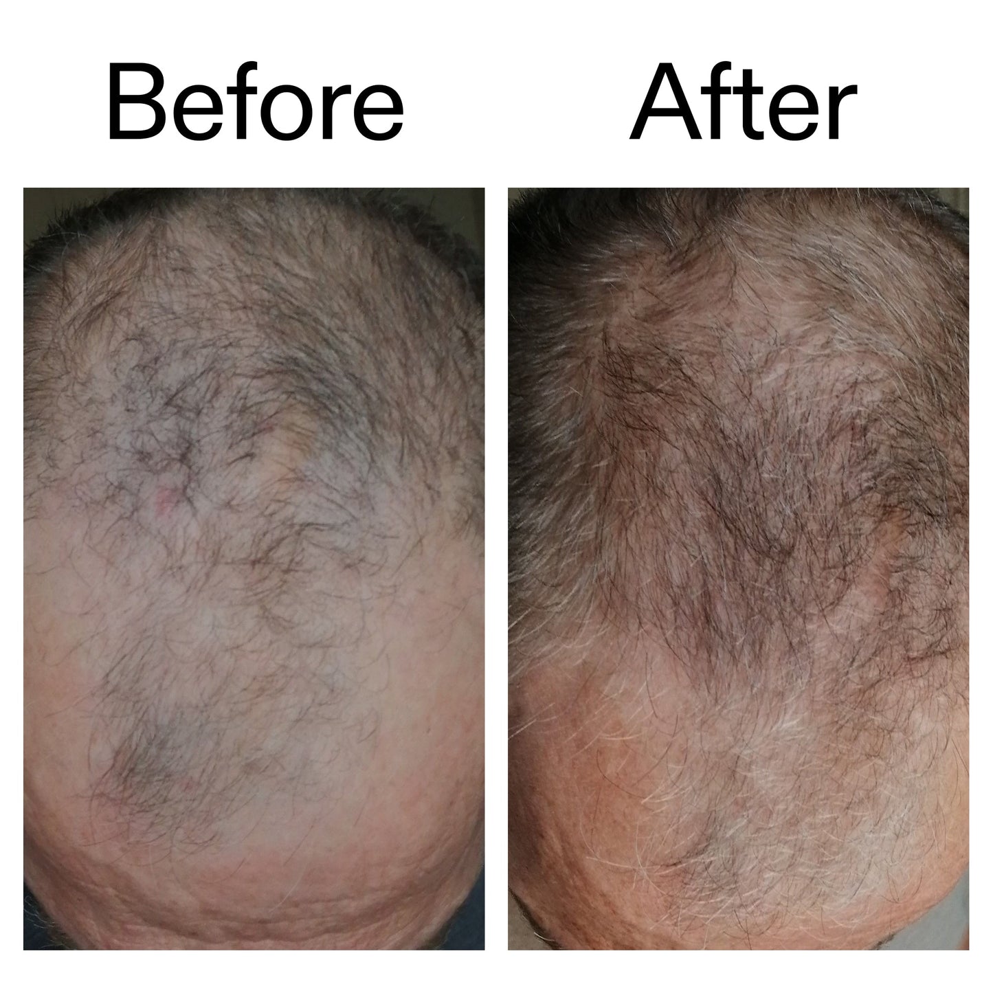 caffeine-stimulating-scalp-treatment-k1 Caffeine_Scalp_Treatment_B_A_Ppage_2000_x_2000.jpg