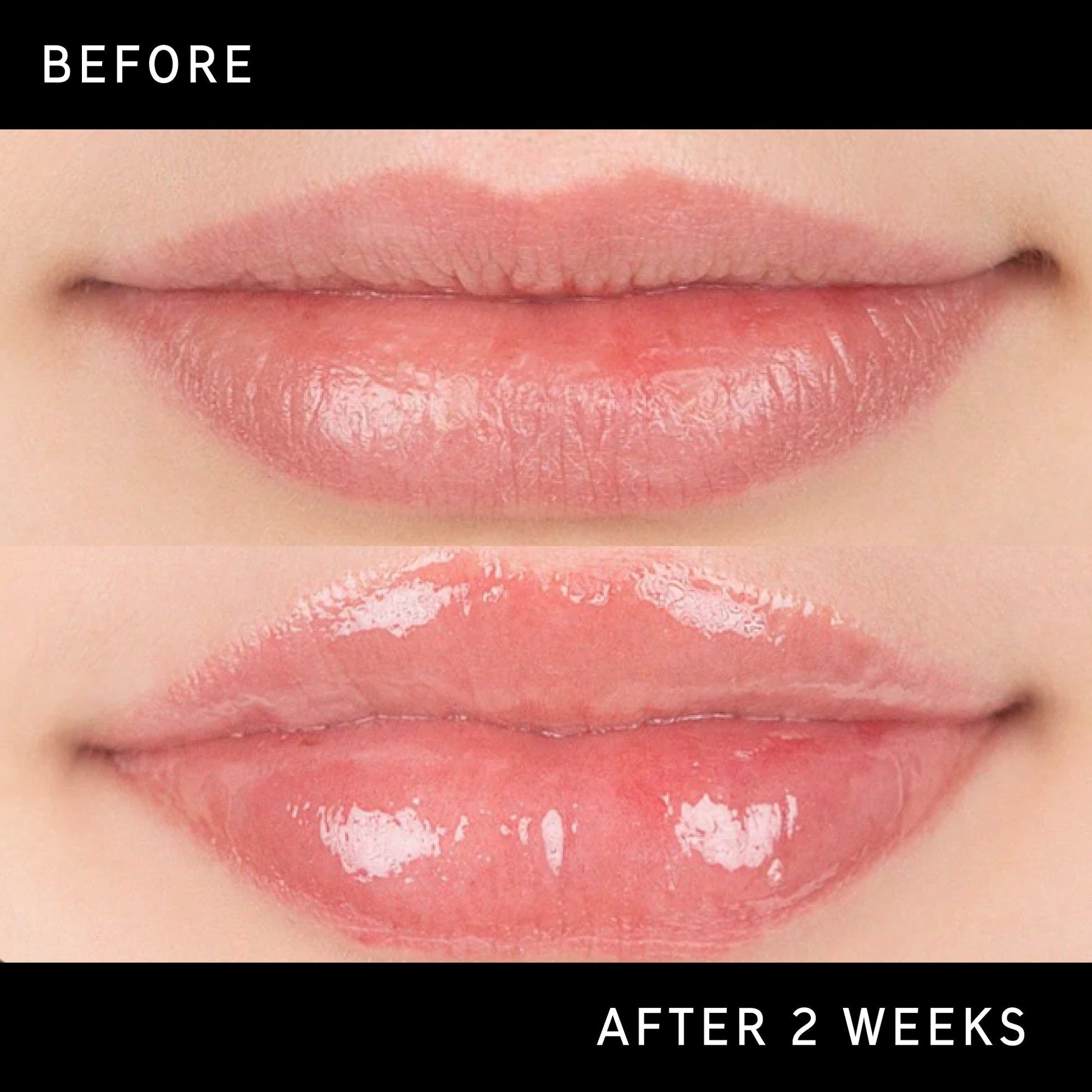 lip-plumping-duo-e4 DTC-Top15_Amends_Tripeptide-Lip_B_A.jpg