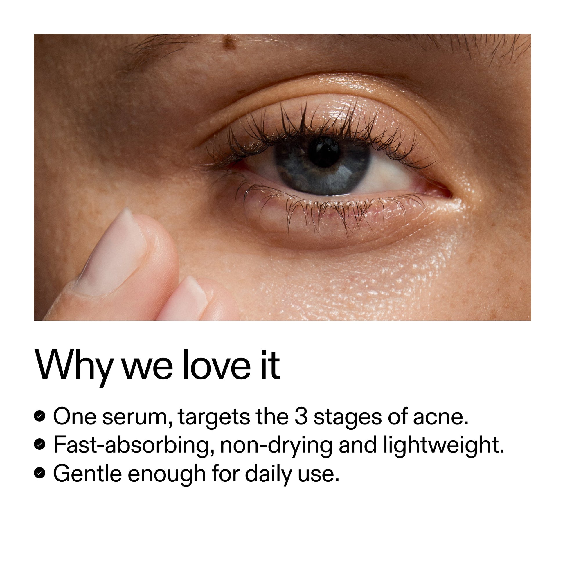 360-acne-clearing-serum-u2 Dioic_Whyweloveit_2000x2000_175aafd3-0cbe-403a-b317-a8362881bfe2.jpg