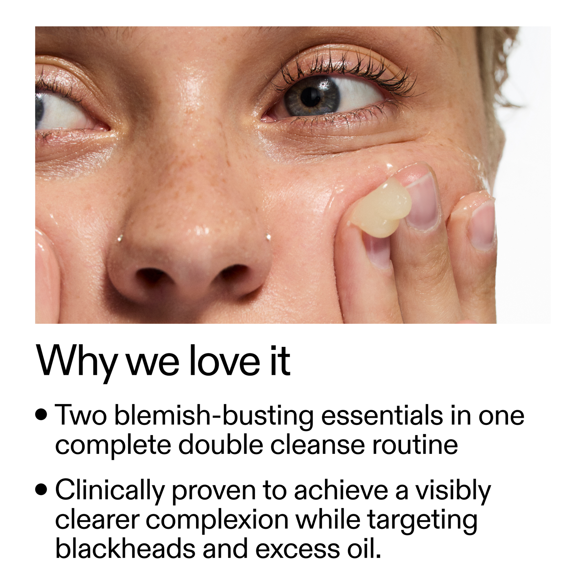 acne-double-cleanse-duo-u6 Double_Cleanse_Duo_for_Breakouts_Why_We_2000x2000_f242cb12-bb5c-487c-b203-071ccb406ec5.png