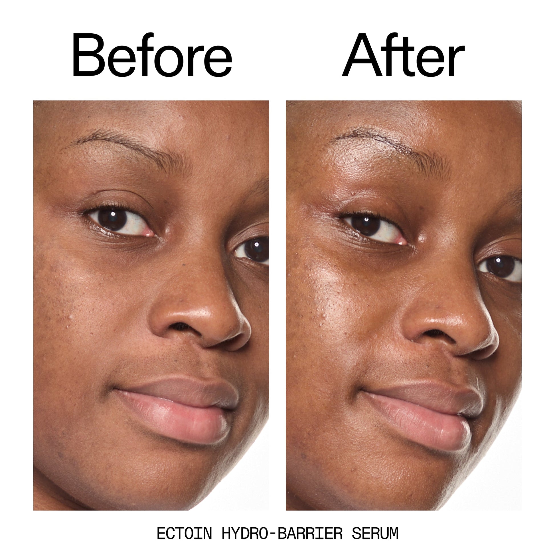 barrier-boosting-trio-c8 Ectoin_Before_After_2000x2000_ce35bc41-4da0-4b6f-adc7-29f8641f6c6c.jpg
