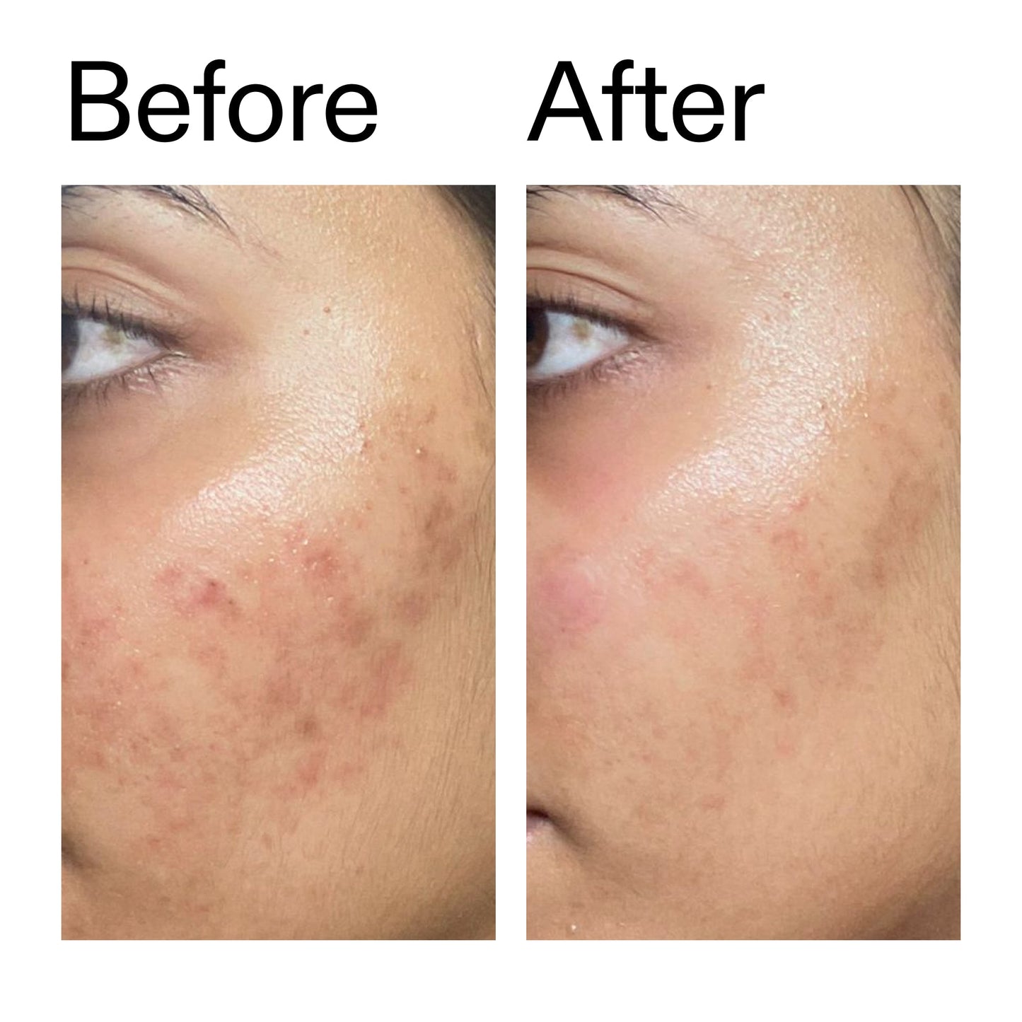 ectoin-hydro-barrier-serum-j3 Ectoin_Hydro-barrier_Serum__Before_After_2000x2000_34261920-d004-48d0-9c7b-8e1c15971bfd.jpg