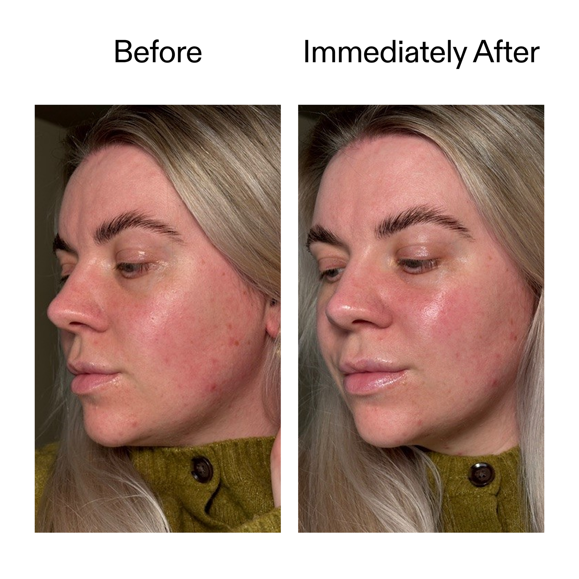 exosome-hydro-glow-complex-duo-s2 Emma_2000x2000_6120d012-22a6-496f-818d-ecc8e2024a78.png