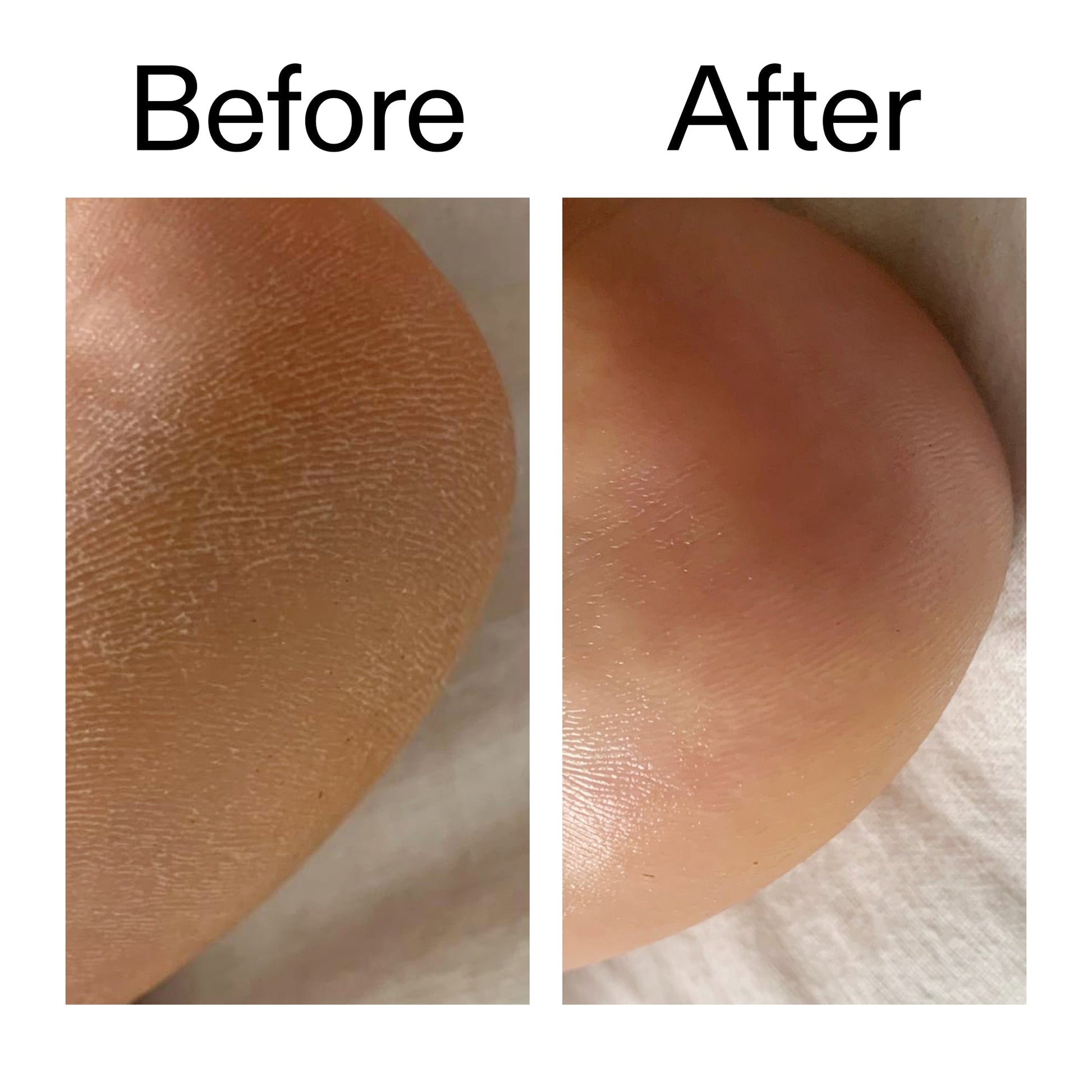 glycolic-acid-exfoliating-body-stick-duo-n3 Glycolic_Acid_Exfoliating_Body_Stick_Before_After_V1_2000x2000_a3043625-9400-429a-a7fb-d6dbd220f722.jpg