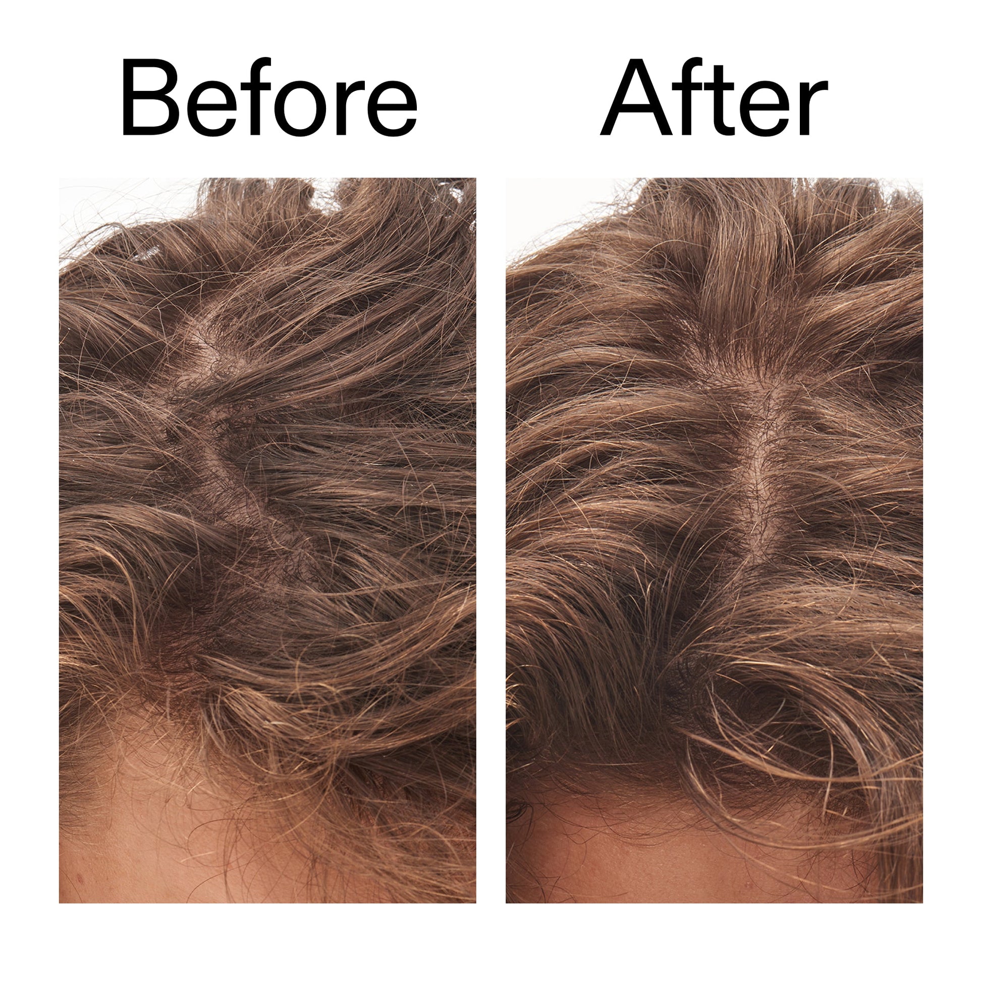 glycolic-acid-exfoliating-scalp-scrub-r6 Glycolic_Acid_Exfoliating_Scalp_Scrub_Before_After_2000x2000_b8561c87-05a1-4caa-80f7-1b6b33d750f7.jpg