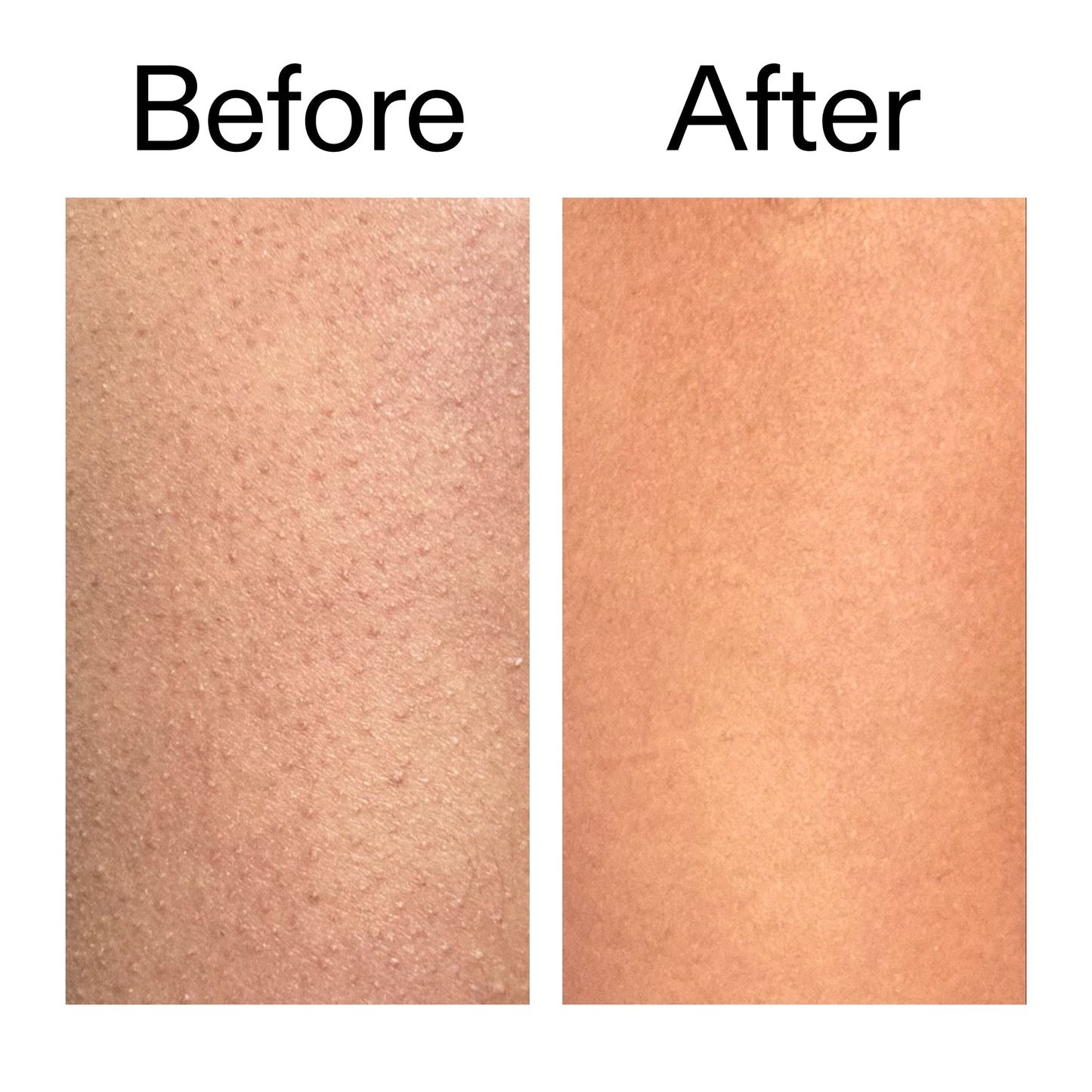 glycolic-acid-exfoliating-body-stick-duo-n3 Glycolic_Body_Stick_B_A_2000x2000_6e6e6b4d-5bd7-43c0-aeed-4d66788e8995.jpg