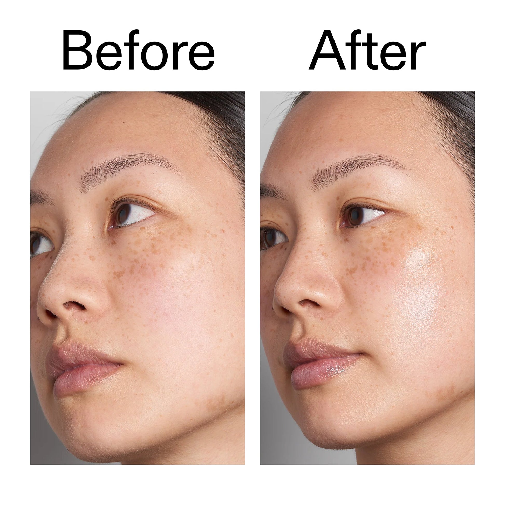 supersize-hyaluronic-acid-serum-100ml-duo-q0 Hyaluronic_Acid_Before_After_2000x2000_d7983956-8aa2-4ea3-8255-c63e8d4f892e.jpg