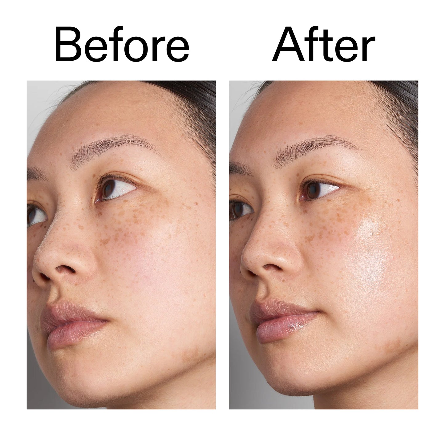 hyaluronic-acid-serum-60ml-y3 Hyaluronic_Acid_Before_After_2000x2000_d7983956-8aa2-4ea3-8255-c63e8d4f892e.jpg