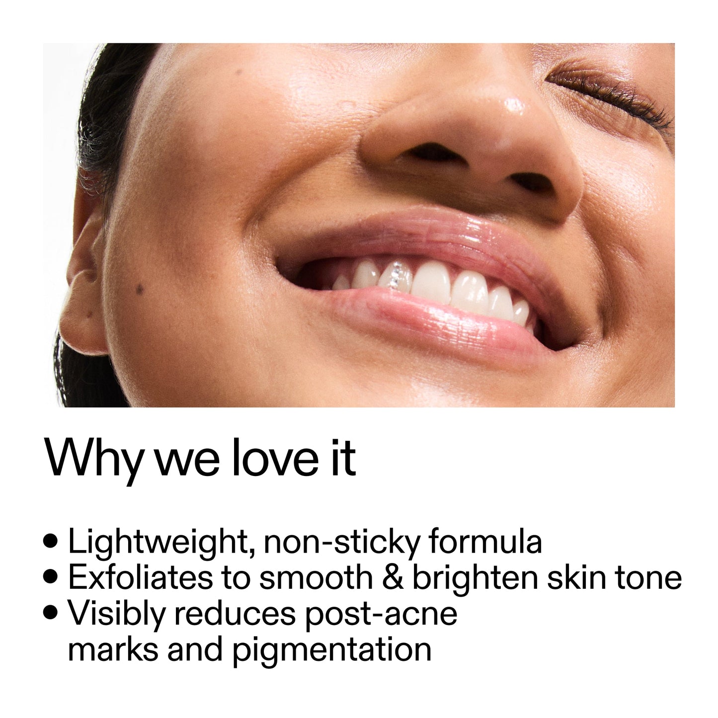 mandelic-acid-treatment-g0 Mandelic_Acid_Treatment_Why_we_love_it_2000x2000_6dfe29a9-2a79-464f-a5e8-e5ac37d93388.jpg
