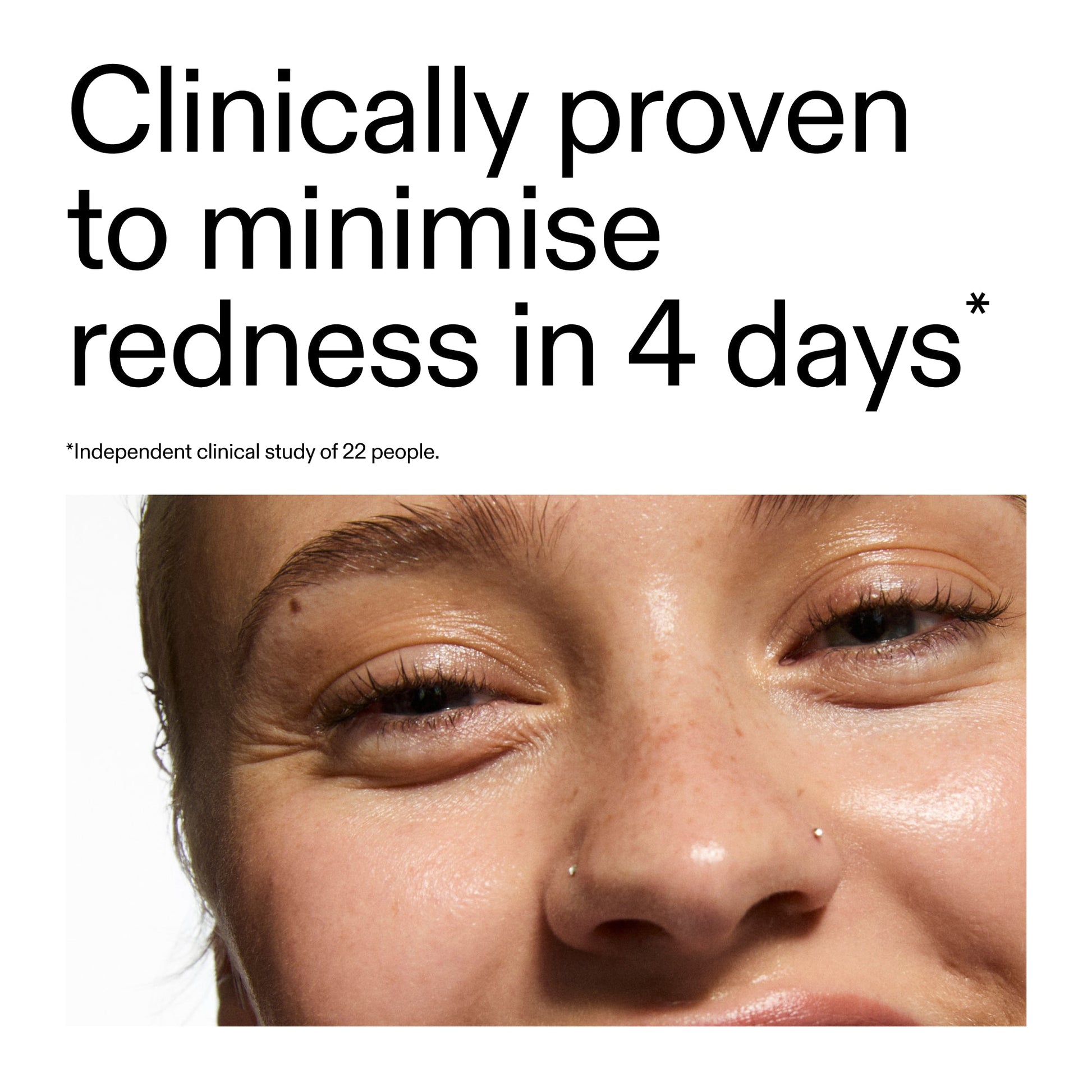 10-azelaic-acid-serum-for-redness-relief-d4 Oat_Cleansing_Balm_Claim_2000x2000_52a841dc-353c-4f2c-8646-3aadb604507d.jpg