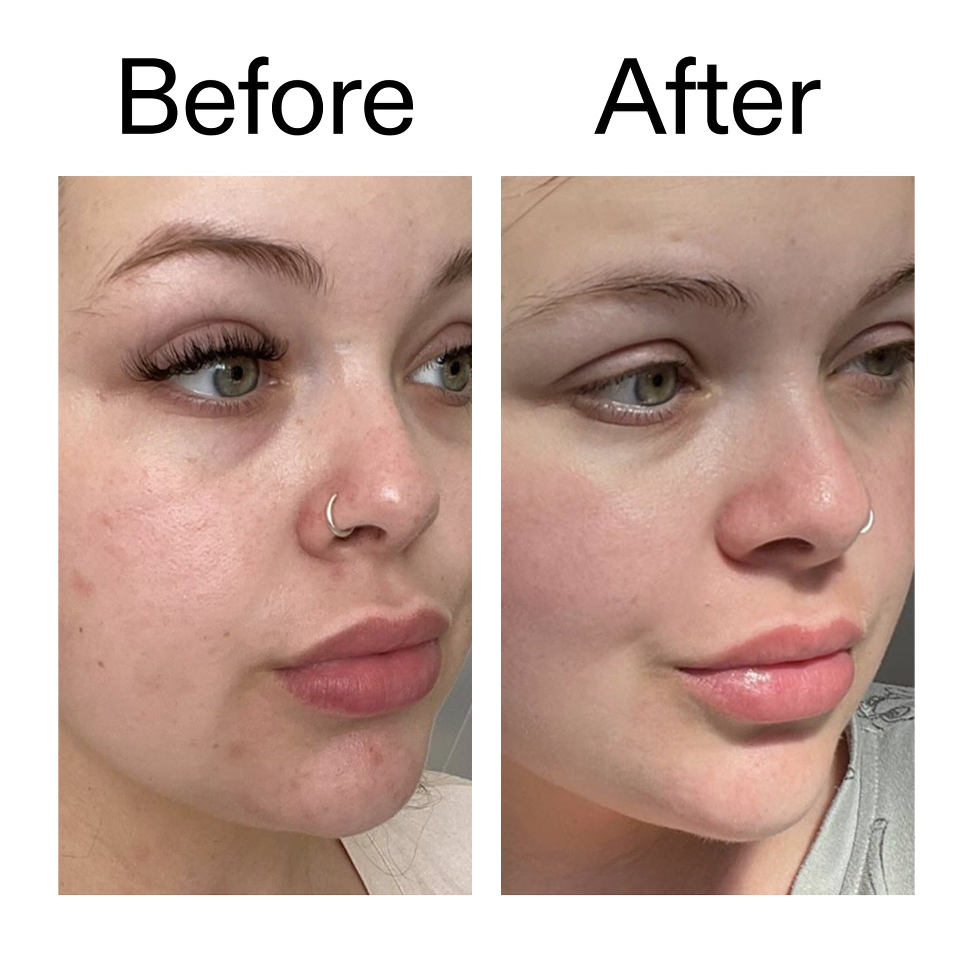 omega-water-cream-50ml-a0 Omega50_Before_After_2000x2000_46483ed8-3f9d-487f-9a0c-9df79830bd65.jpg