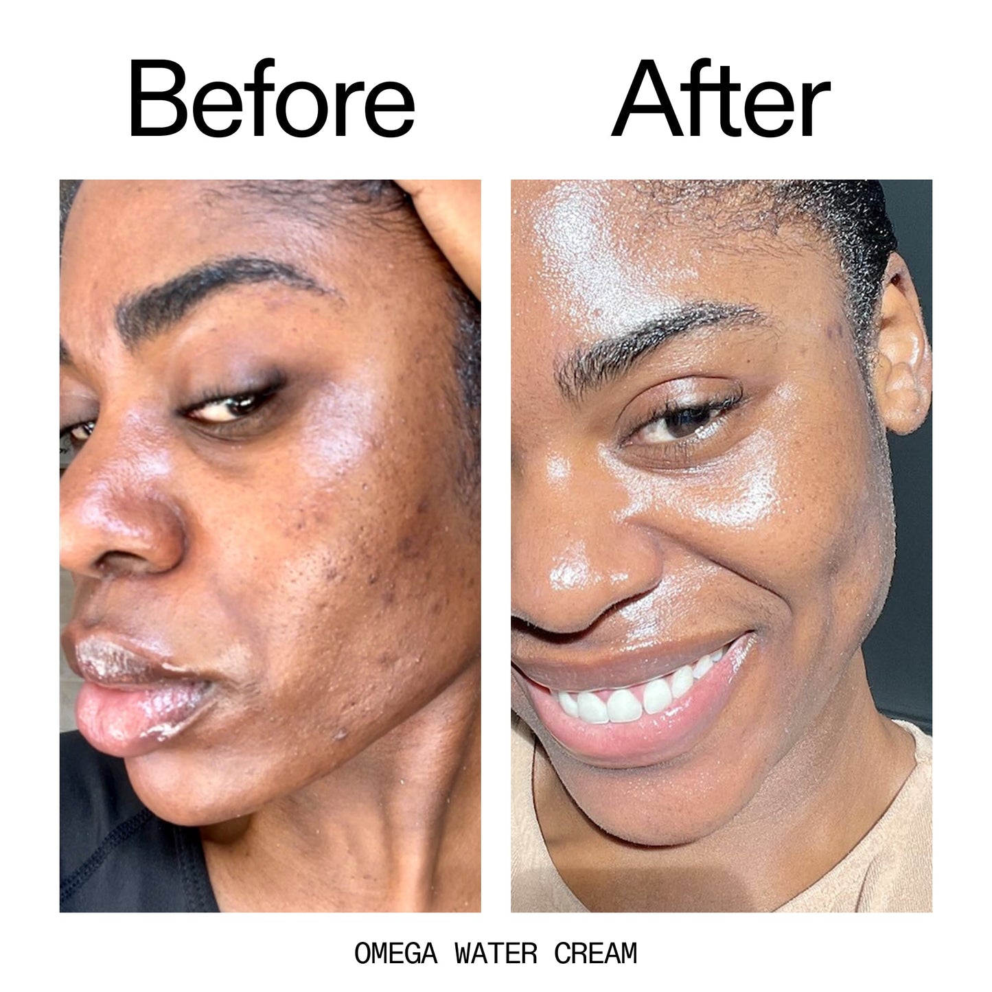 hydrating-cleanser-and-moisturizer-duo-c6 Omega_Water_Cream_Before_After_2000x2000_8e88278b-8c8d-48dc-ac77-4e98ebbd1b77.jpg