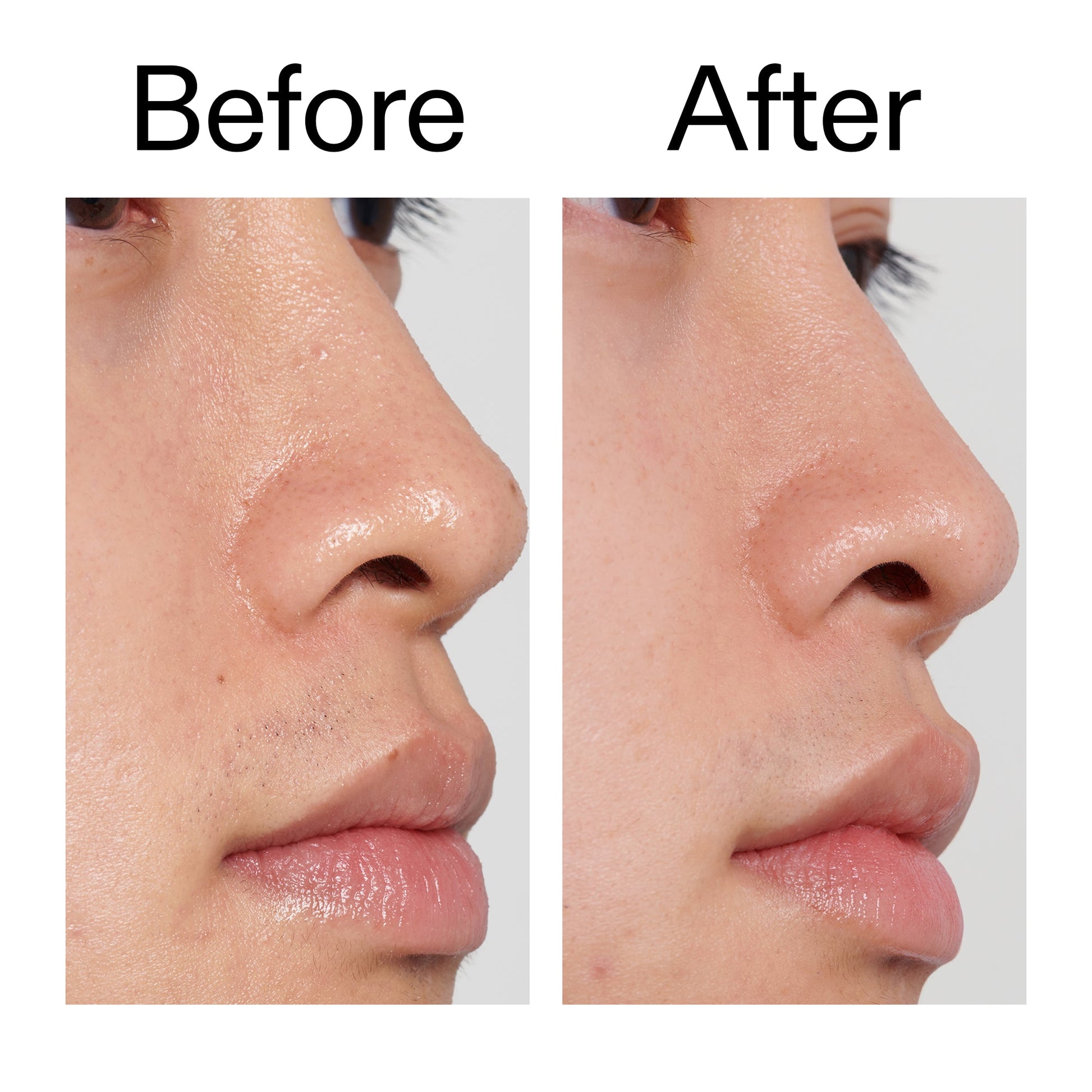 pha-toner-r9 PHA_Toner_Before_After_2000x2000_e3c10172-0150-4342-8b95-57417eaff50d.jpg