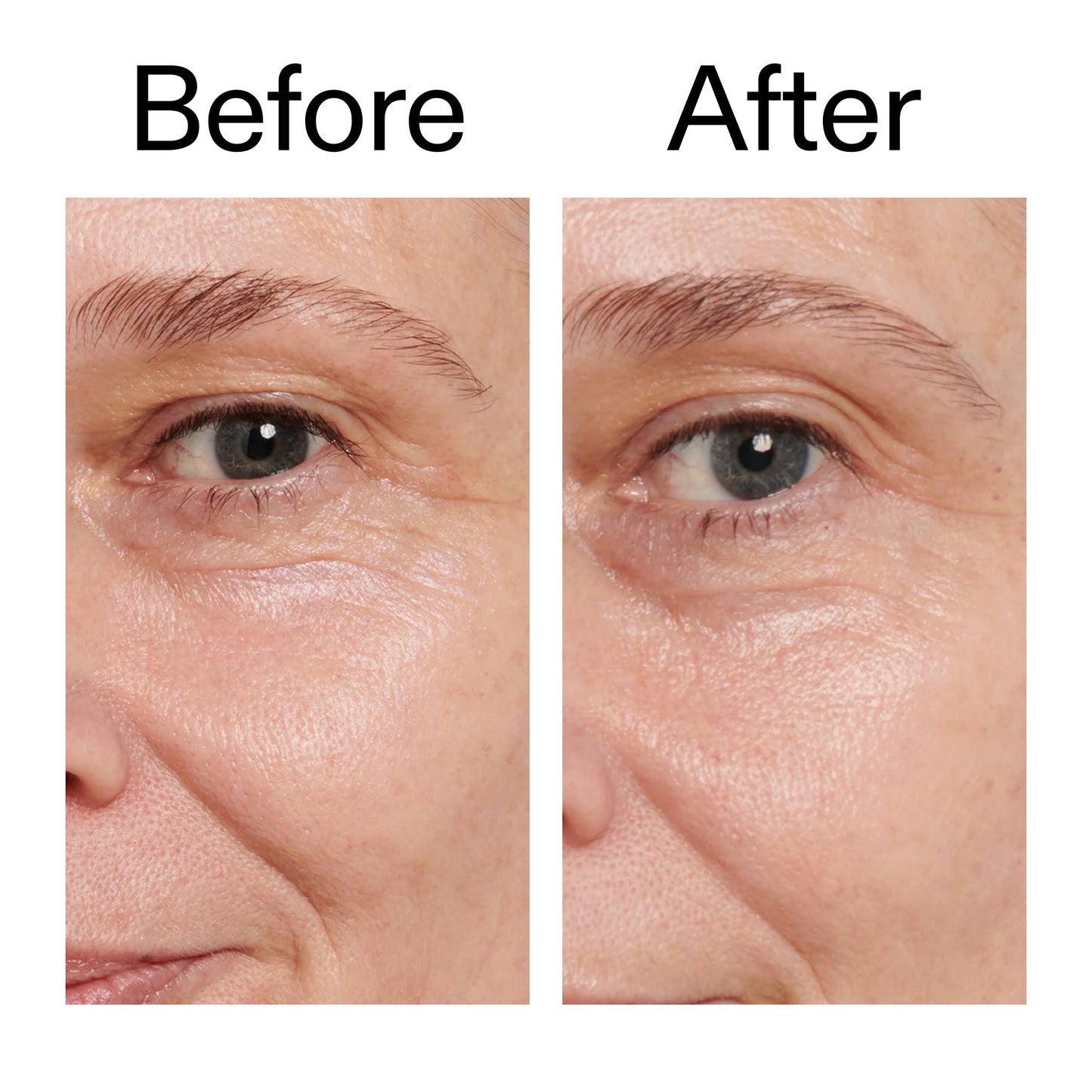 retinol-eye-cream-j8 Retinol_Eye_Cream_Before_After_2000x2000_ac03a80c-109e-4572-a95a-91dc109b4d27.jpg