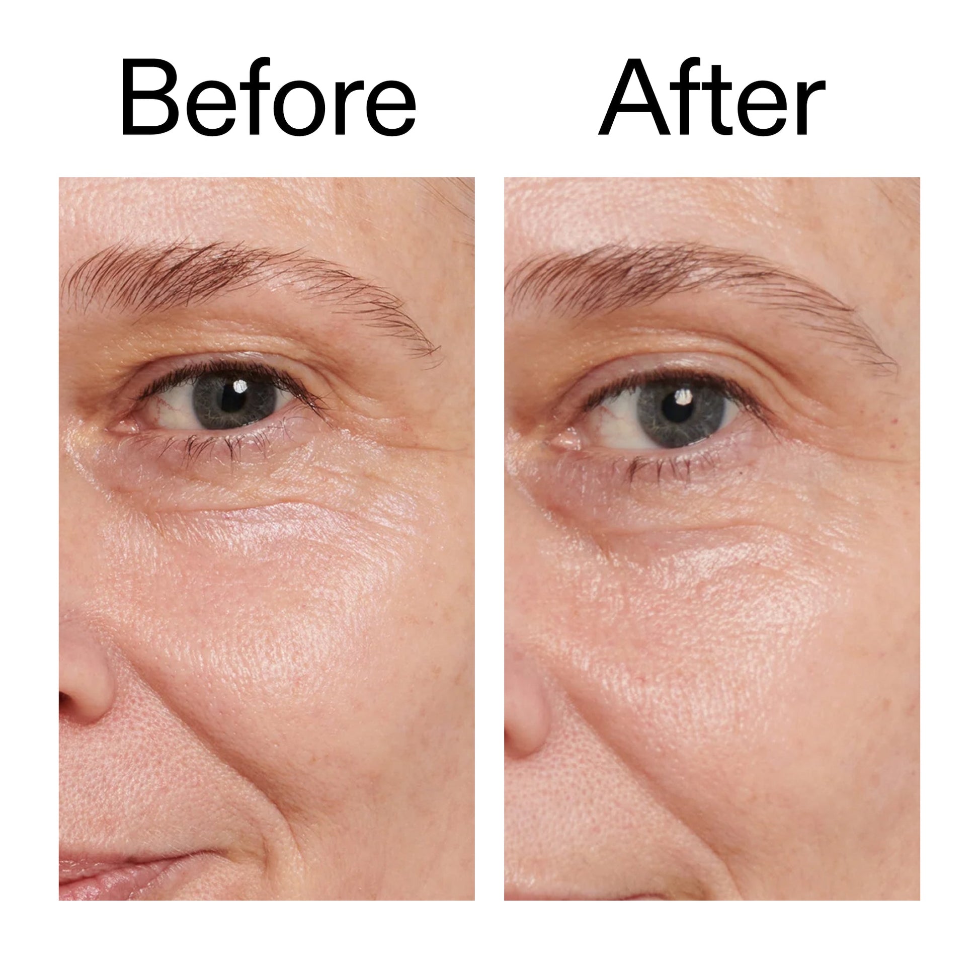 retinol-eye-cream-j8 Retinol_Eye_Cream_Before_After_2000x2000_ac03a80c-109e-4572-a95a-91dc109b4d27.jpg
