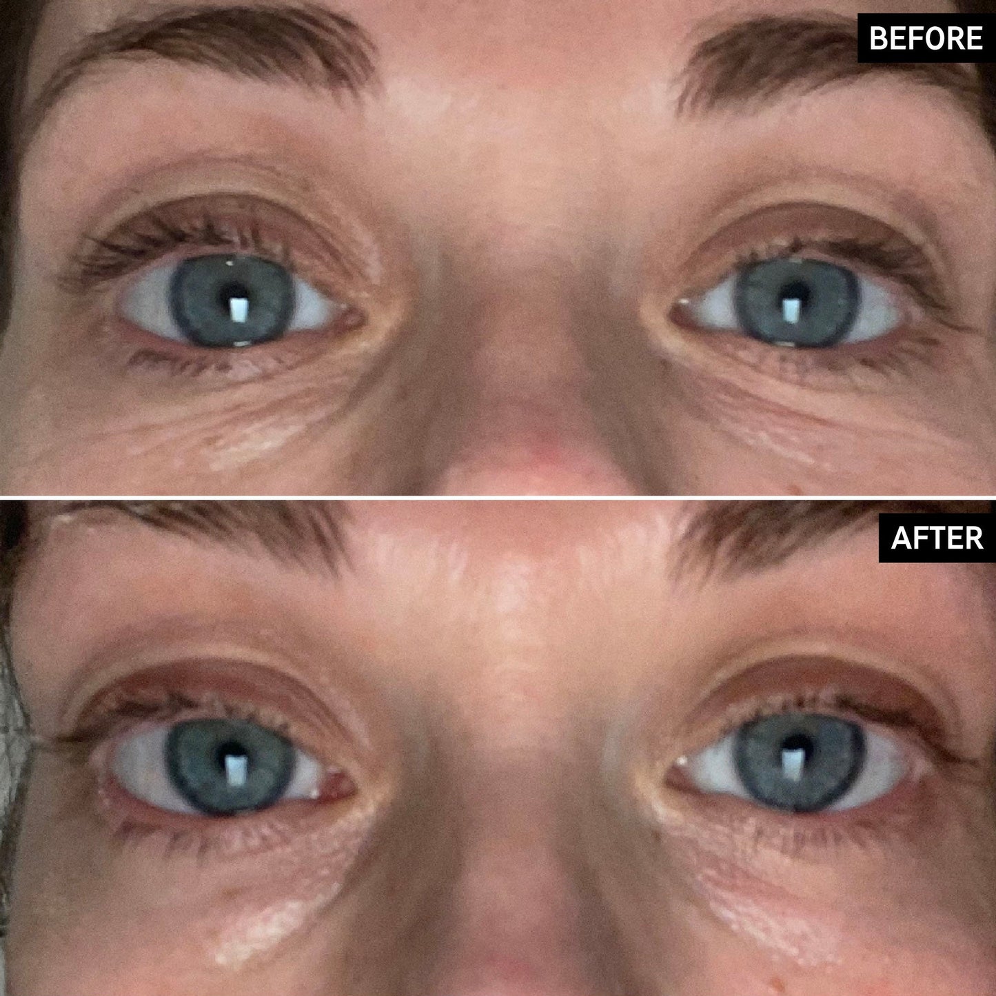 retinol-eye-cream-j8 SITE-UGCBAsApril_Nicole_B_A_PPage_2000x2000_1.jpg