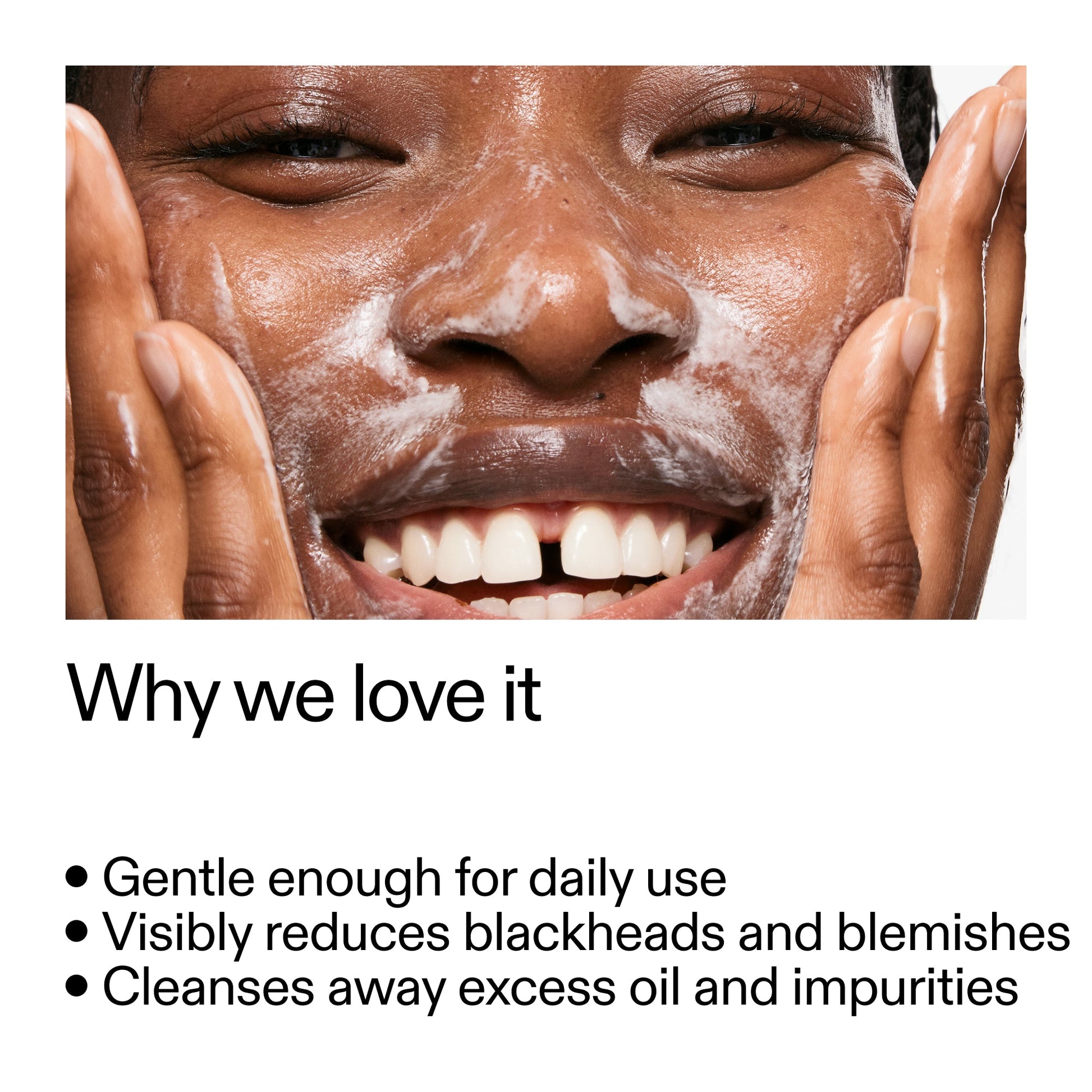 salicylic-acid-cleanser-duo-s7 Salicylic_Acid_Cleanser_-_300mlWhy_we_love_it_2000x2000_87dc92a9-2559-4309-98cd-4e570f1be735.jpg