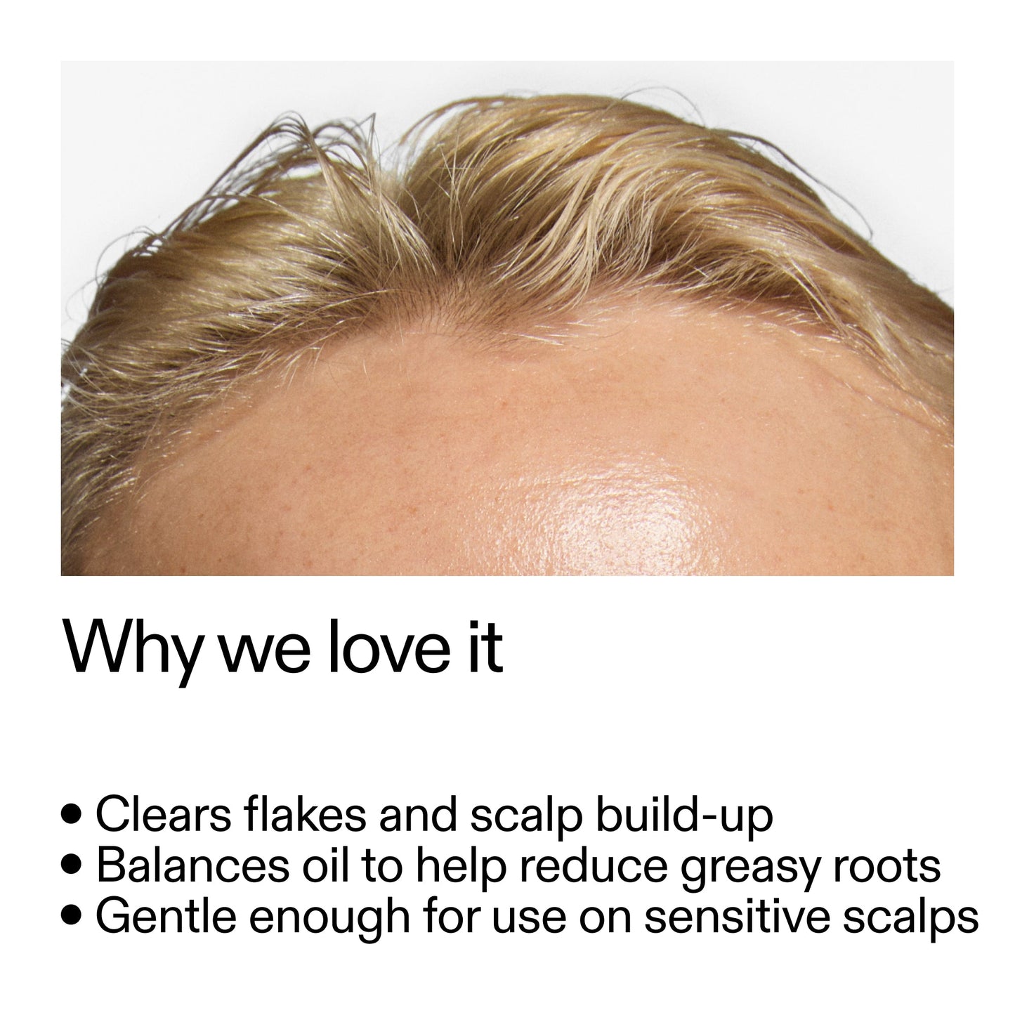 salicylic-acid-exfoliating-scalp-treatment-q1 Salicylic_Acid_Exfoliating_Scalp_Treatment_Why_we_love_it_2000x2000_44b6bd6d-9ec4-4b23-9dc4-bc3fd6f28e14.jpg
