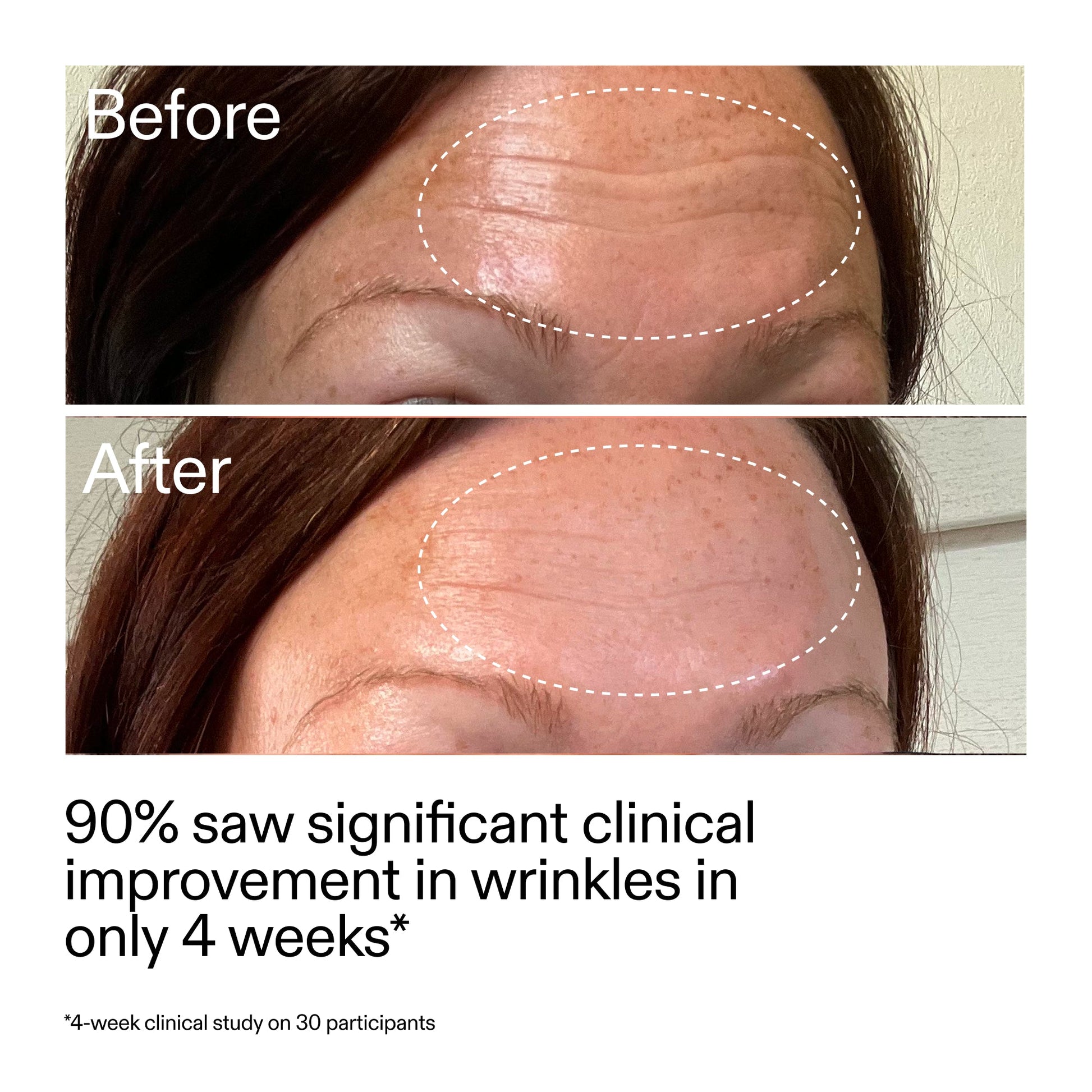 starter-retinol-serum-o2 StarterRetinol_BeforeAfter_Claim1_2000x2000_a09b50b6-4688-4527-abae-21bd142b89b7.jpg