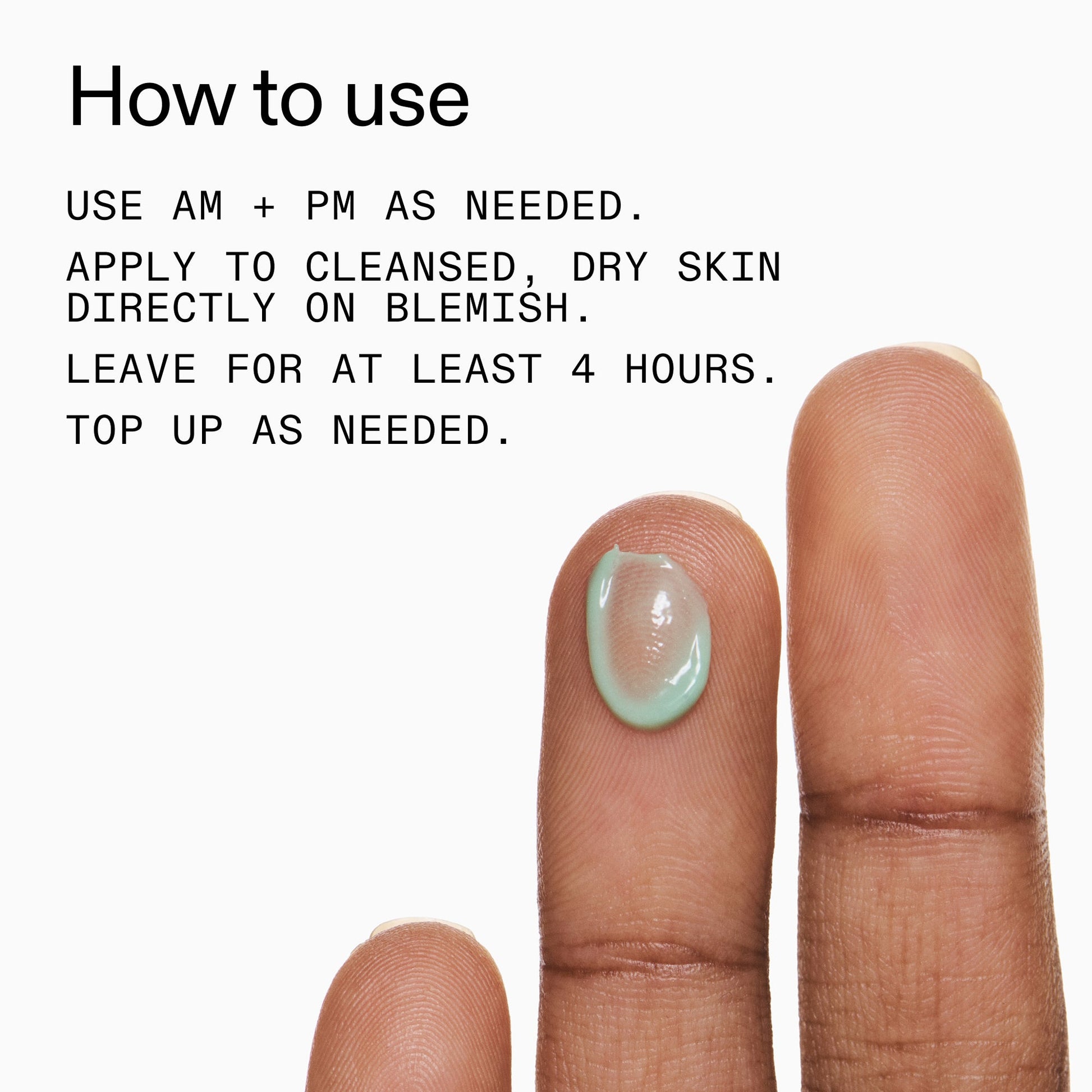 succinic-acid-acne-treatment-u5 Succinic_Acid_Treatment_How_to_Use_2000x2000_d57137d5-d7f1-427c-9a46-5fc00c19c542.jpg