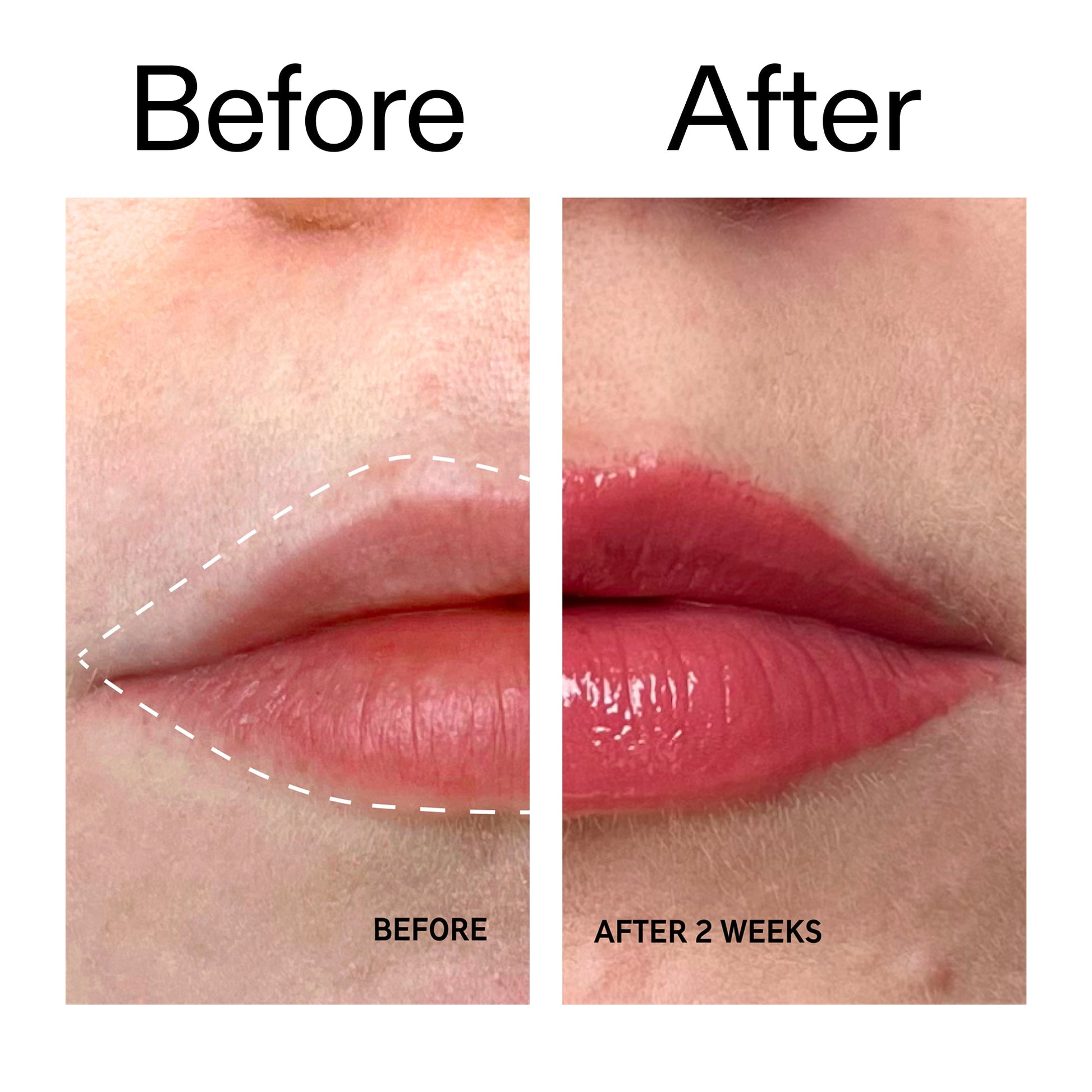 tripeptide-plumping-berry-lip-balm-w1 Tripeptide_Plumping_Lip_Balm_-_Berry_Before_After_2000x2000_9474bbd8-43ca-4b0e-b0e7-dfab70b91927.jpg