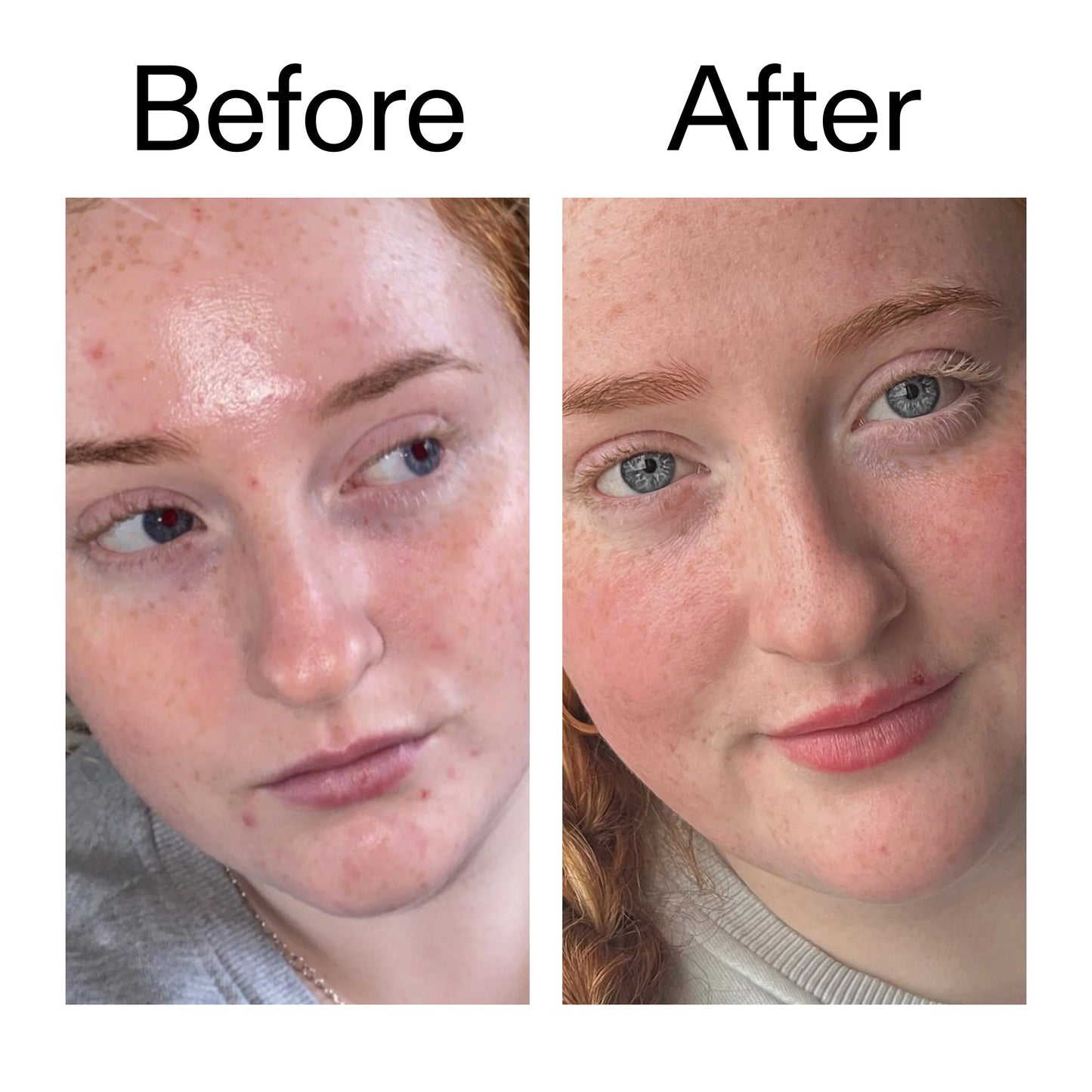 vitamin-b-c-and-e-moisturizer-a7 Vitamin_B_C_and_E_Moisturizer_Before_After_2000x2000_b0781a76-5ad2-4be9-95b8-ef92b356833c.jpg